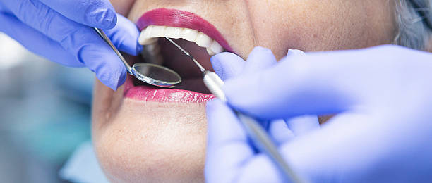 Best Emergency Dentist for Lost Fillings or Crowns in Chesnut Hill, PA